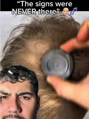 Take care of your scalp health!!!👨🏼‍🦲🧬
