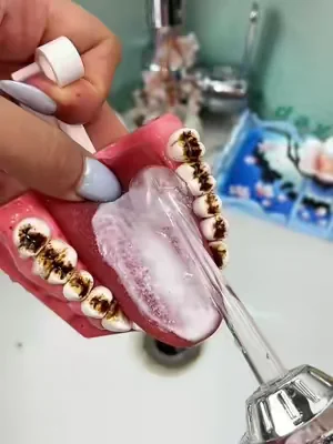 You need it #tiktokshop #dealsforyoudays #teeth 