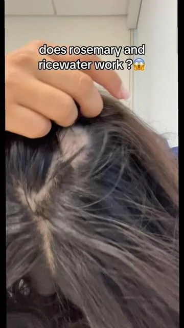 You’re not alone babe.  #hairgrowthjourney #hairgrowthproducts #rosemarywater #hair #paratiiiiiiiiiiiiiiiiiiiiiiiiiiiiiii 