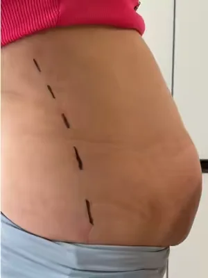 #belly #homeworkout #freeshipping #toktikshop #fyp 