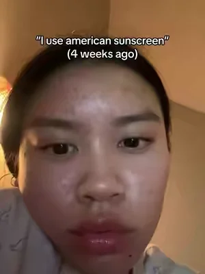 Your SIGN to try it #SKIN1004 #tiktokshopcreatorpicks #tiktokshop #tiktokshop #koreanskincare 