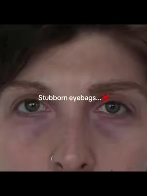 @BASED #tiktokmademebuyit #viral 