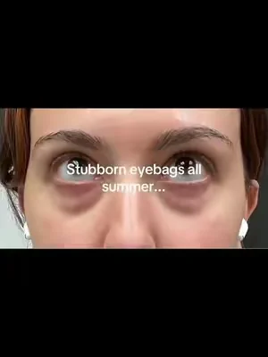 @SKIN1004 US #tiktokmademebuyit #viral 