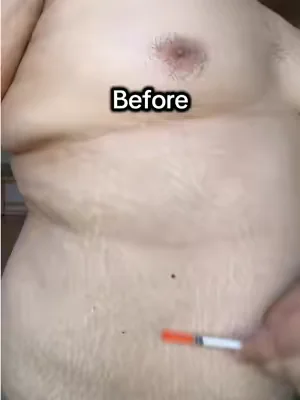 Westmore beauty body coverage hides all the stretch marks #westmorebeauty #bodymakeup 
