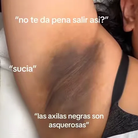 Resulta may vary axilas underarms manchas desodorante como oler rico #glowuptips #dealsforyoudays #beautytips #resultsmayvary #MomsofTikTok 