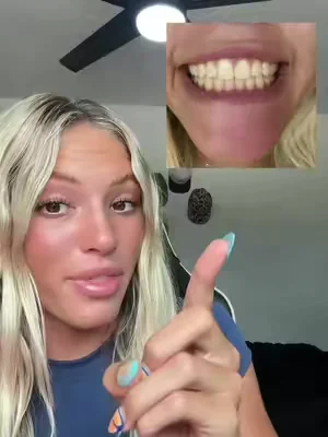 7654383258297208095