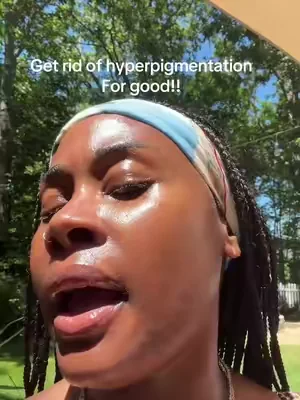 #blackgirlsunscreen #sunscreen #hyperpigmentation #skin1004 