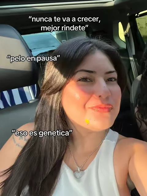 Caida y crecimiento ! Results may vary #glowuptips #dealsforyoudays #MomsofTikTok #resultsmayvary #beautytips 