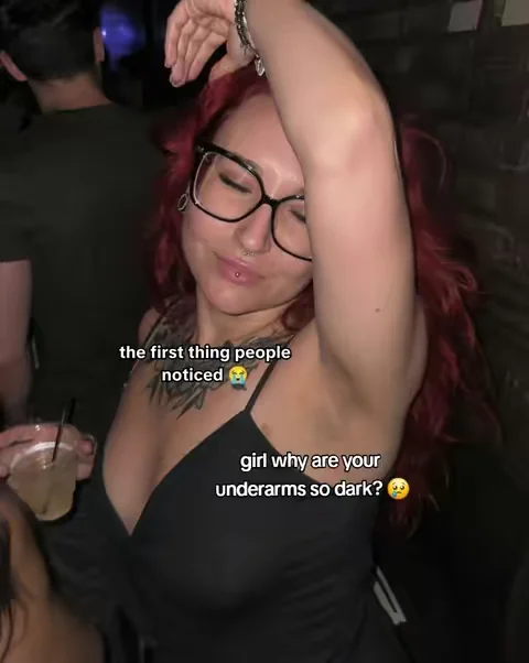 dark underarms used to haunt me! Until I used kojic acid and tumeric 