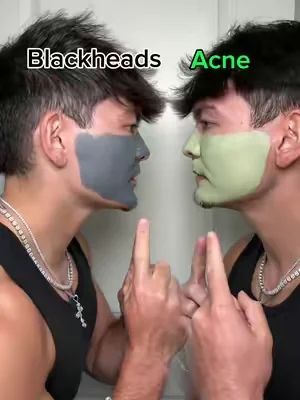 Become unrecognizable for the summer #SKINTIFIC #ClayMask #SkincareTikTok #DeepPoreCleanse #TikTokShopFinds 