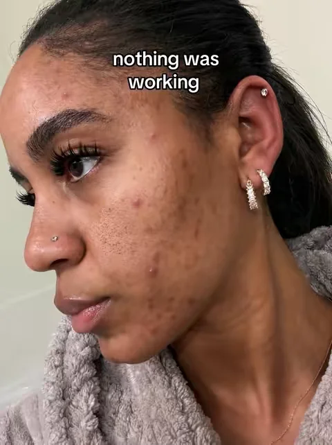 😩😩😩