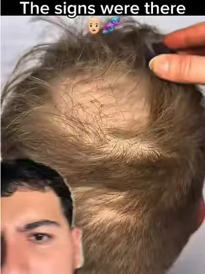 Why do you guys allow this to happen😒👨🏼‍🦲🧬