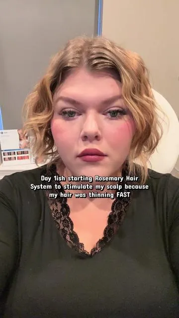Worth watching to the end 🫣 #dealsforyoudays #dfyd #summervibes #thinhairhacks #rosemaryshampoo 