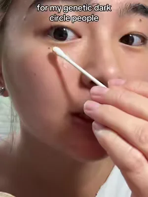 grandma is loving it #geneticdarkcircles #darkundereye #eyebags #koreanskincare #darkcirclesundereyes 