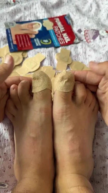 You won’t believe what one week of using this patch did to my feet!✨#nailfungus #nailrepair #uglynail #yellownails #DealsforYouDays