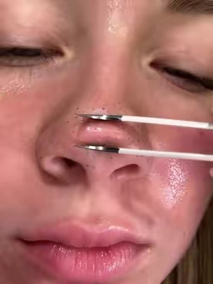 10 minutes. That's all it takes to unclog years of buildup.@Dr.Leo-USA #kbeauty #acne #blackhead #oilyskin #claystick 