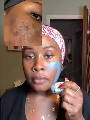 @Skintific Official #largepores #skincare 