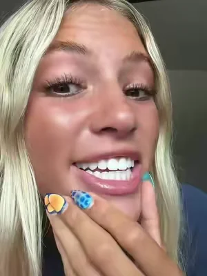 7654630325665942814