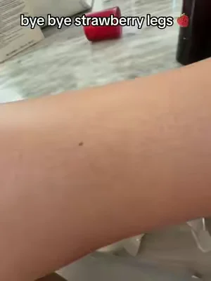 strawberry leg hack