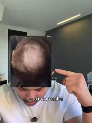 Porque cuidar tu cabello no es una moda, es parte de tu autocuidado diario 👌 #hairgrowthvitamins #hairgrowthsupport #hairgrowthformula #hairgrowthcare #hairwellness    