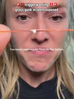 THIS IS DISGUSTINGLY SATISFYING!!! it like it’s up in the gums… No wonder my breath stank, even after regular flossing #nobs #floss #expandablefloss #dealsforyoudays #badbreath 