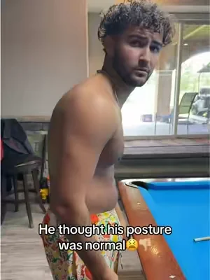 Bad posture hurts your BACK, NECK, & SHOULDERS😭‼️ #vkn #posturecheck #posturecorrection #DealsForYouDays #tiktokshopcreatorpicks 