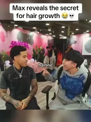Max reveals the secret for his hairline! #hairgrowth #bebodywise 