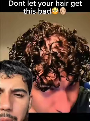 Take care of your scalp health!👨🏼‍🦲🧬