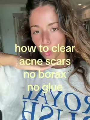 my skin has literally never been better #skincare #skintok #glowup 