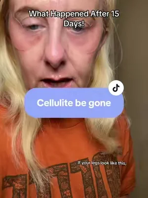 I finally understand why everyone is talking about this Cryo Thermo Firming Gold Gel 👀 The cooling-to-warming sensation feels so luxurious, and it leaves my skin feeling refreshed and looking smoother. If you’ve been wanting to upgrade your body care routine, this one is worth checking out ! #CryoThermoFirmingGoldGel #tiktokmademebuyit #bodycaremusthave #summermusthave #tiktokshopcreatorpicks