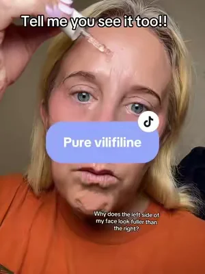 The one-side test convinced me faster than any review ever could ✨ I switched to Pure Volufiline and applied it only to my smile line and cheek area on one side of my face. The difference in the look of hydration and fullness has me doing double takes. #Volufiline #trendingnow #skincarefinds #selfcareroutine #tiktokshopcreatorpicks