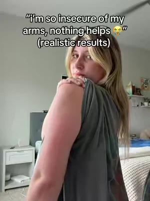 no more hiding my arms 🥲 #KP #strawberryskin #skintransformation #summerwins #dealsforyoudays 