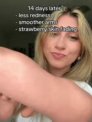 after years of hiding my arms, finally found something working to clear my KP 🥲 #KP #strawberryskin #skintransformation #summerwins #dealsforyoudays 