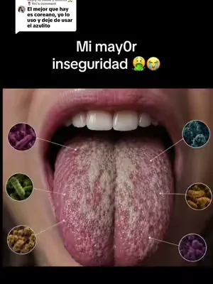 Replying to @Salud y Belleza 🙏🌷Vel Si eres sensible a lo asqueroso no mires el video esto te saca hasta tus más sucios pecados entre los dientes #idwhitening #mouthwash #dealsforyoudays #summervives #tiktokshopcreatorpicks @Hismile US 