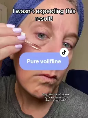 I’ve been testing Pure Volufiline on just one side around my smile line and cheek area, and that side looks noticeably more hydrated and plump-looking to me!! #Volufiline #tiktokmademebuyit #viralbeauty #skincareroutine #tiktokshopcreatorpicks