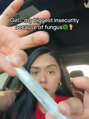 #fungus #nailfungus #toenailfungustreatment #toenail 