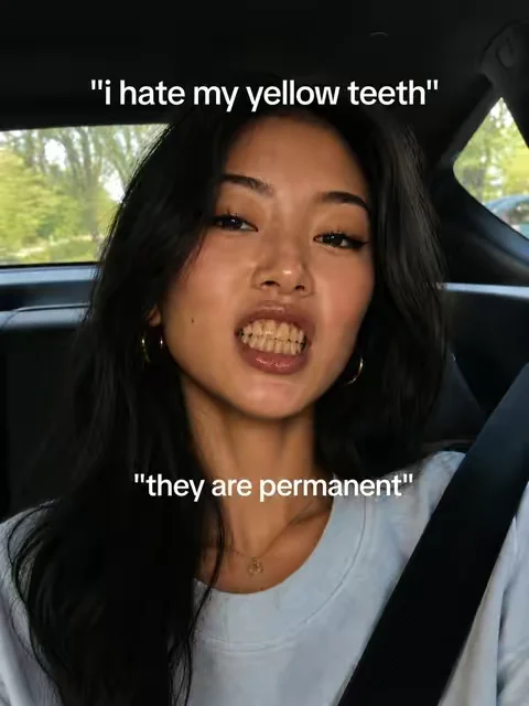 ☝️#drdent #drdentteethwhitening