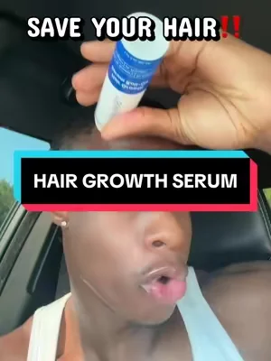 Hair Growth Made Easy‼️#hairgrowth #rootlabs #hairline #balding #dealsforyoudays @RootLabs 