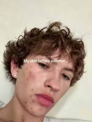 @Dr.Leo-USA #tiktokmademebuyit #dealsforyoudays #viral 