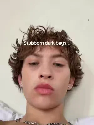 @SKIN1004 US #tiktokmademebuyit #dealsforyoudays 