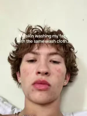 @Clean Skin Club #tiktokmademebuyit #dealsforyoudays #viral 