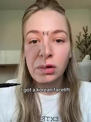 I love my korean facelift #skincare #aginggracefully #koreanskincare #drmelaxin 