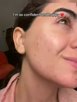 Truly so happy in my own skin now #dealsforyoudays 