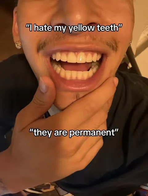 ☝️#drdent #whiteteeth #toppicksforyou