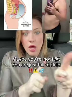 Double chin, puffy face, thick waist? Could need lymphatic drainage. 