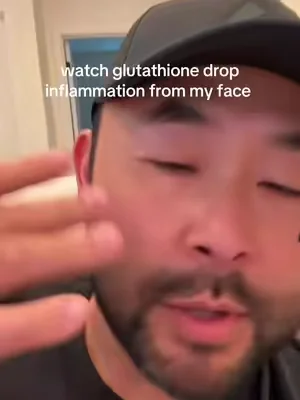 One of the best decisions I ever made #glutathione #inflammationrelief #inflammation #puffyface #snatched 
