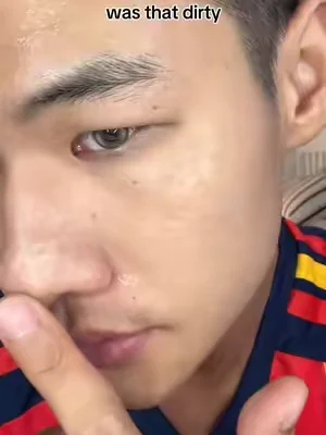 Stop squeezing! This volcanic clay mask pulls out ALL the gunk in 10 mins – no redness, no irritation 😱#DealsForYouDays #skincare #blackhead #cleanskin #drleohonestreview 