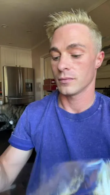 Snakebite to the face #cosrx #dfyd #dealsforyoudays #Summerwins #viraltiktok 