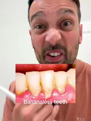 electric toothbrush, AI toothbrush, power tooth scraper, plaque remover tool, oral care gadget, rechargeable toothbrush, smart oral care, dental hygiene routine, bathroom gadgets, teeth cleaning routine, self care essentials, daily hygiene, TikTok oral care finds, grooming gadgets, electric dental tools #DealsForYouDays #OralCare #ElectricToothbrush #DentalCare #SelfCare