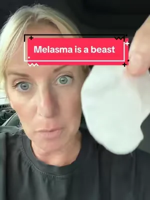 Great for melasma and overall brightening of your skin  #melasma #dealsforyoudays #jiyu